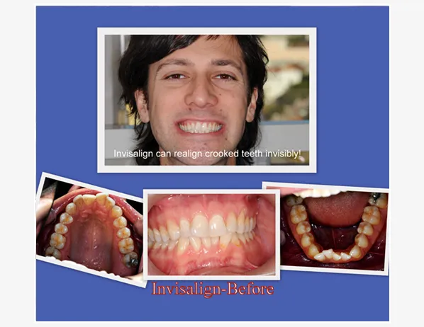 Case_3