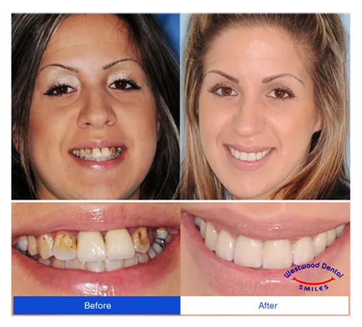 Dentist 90024 Westwood Dentists