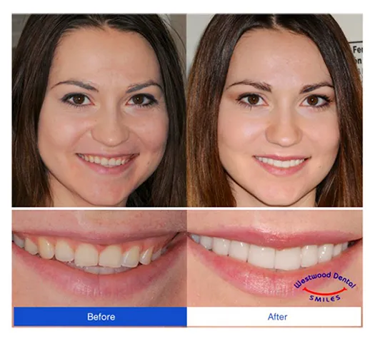 Endodontist 90024 Westside LA
