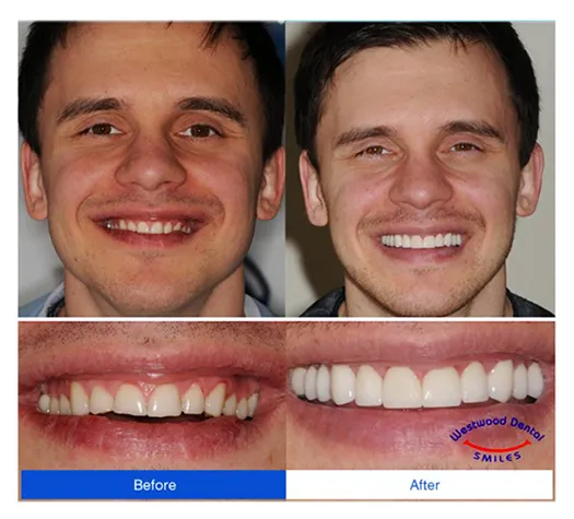 Dentist 90024 UCLA Dental Office
