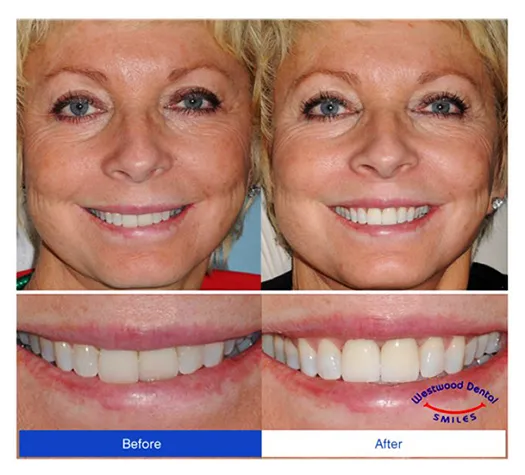 Dentist 90024 Westwood