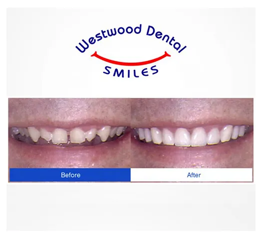 Cosmetic Dentist 90024 Westwood LA