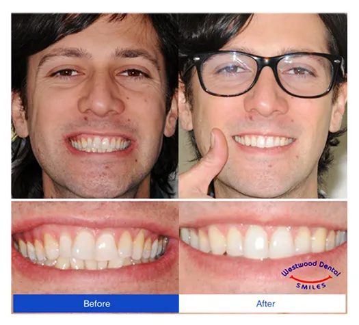 Dentist 90024 UCLA