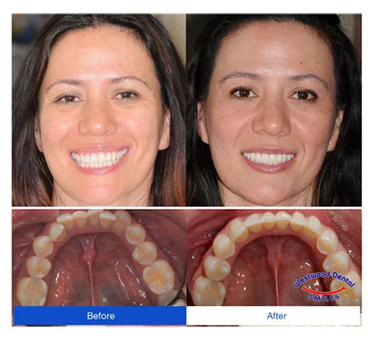 Dentist 90024 Westside LA