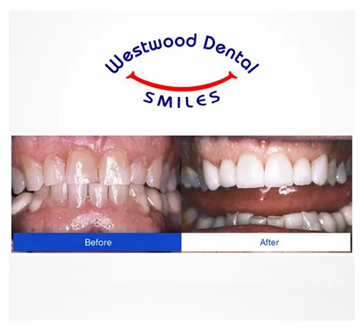 Sedation Dentist 90024 Westside LA
