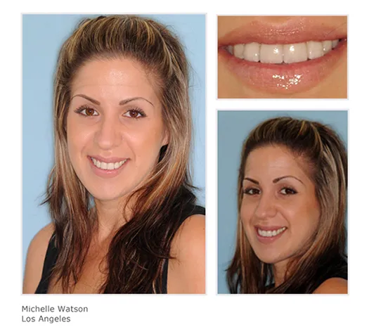 UCLA Campus Dentist